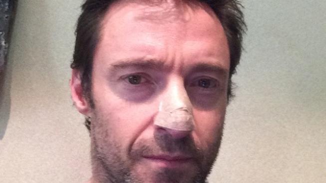 Hugh Jackman