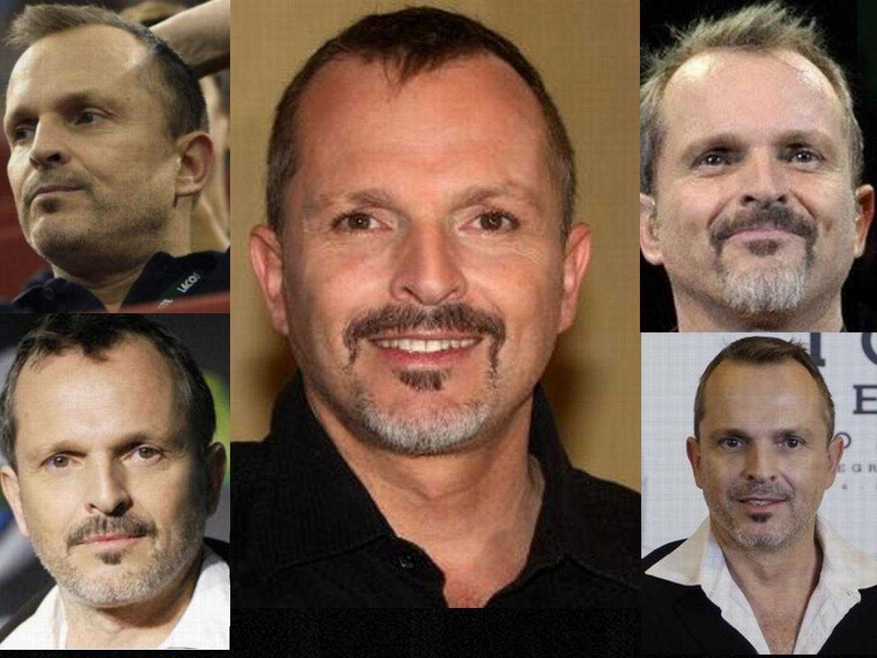 Miguel Bosé