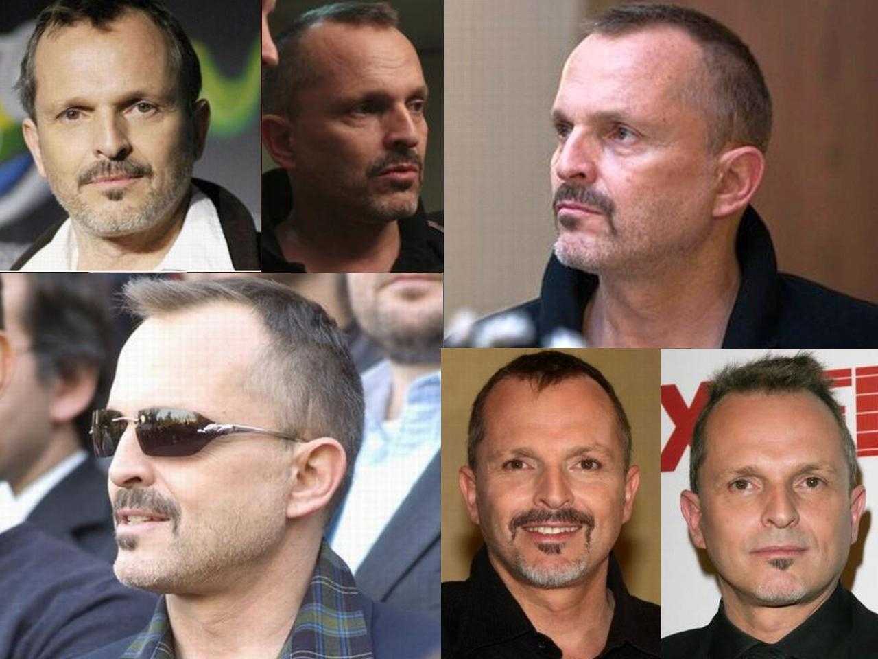 Miguel Bosé