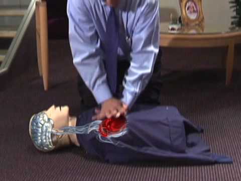 Profilový obrázek - Continuous Chest Compression CPR—University of Arizona Sarver Heart Center