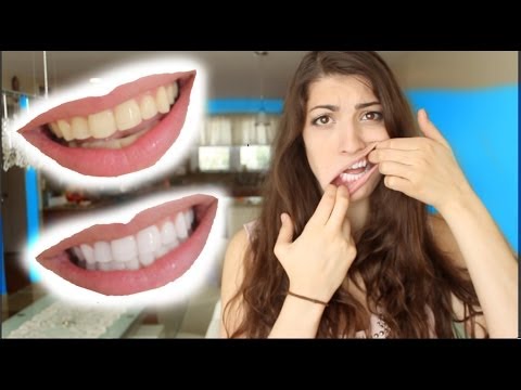 Profilový obrázek - How to Whiten Teeth in 2 Minutes! [guaranteed whiten teeth]