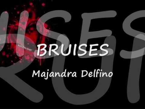 Profilový obrázek - Majandra Delfino - Bruises