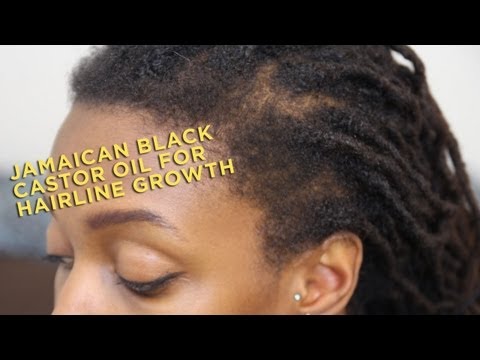 Profilový obrázek - Product Review: Jamaican Black Castor Oil for Hairline Growth