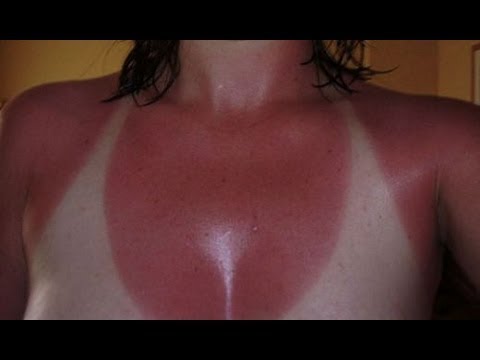 Profilový obrázek - The Difference Between Sunscreen and Sunblock [DermTV.com Epi #281]